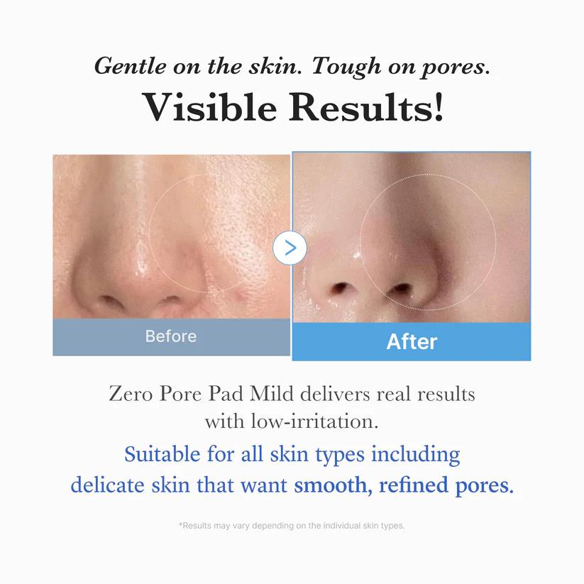 medicube Zero Pore Pad Mild 70 Pads